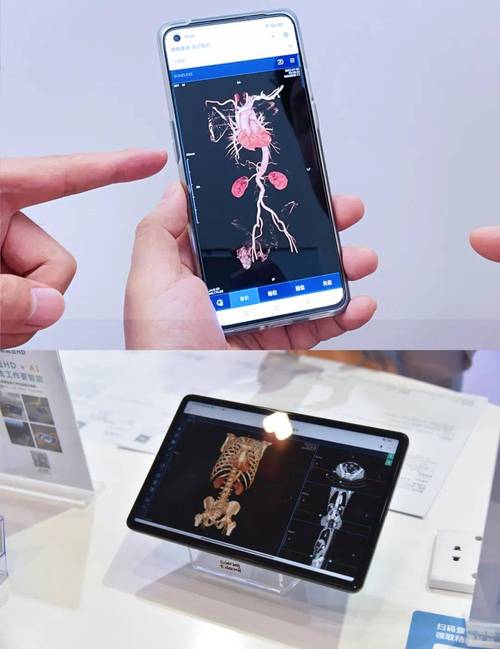 数智赋能助力医院高质量发展盈谷网络携医真全系产品亮相chinc
